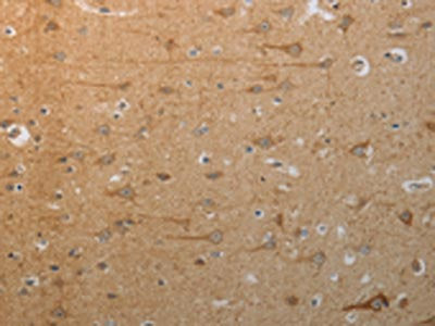 SLC4A7 Antibody