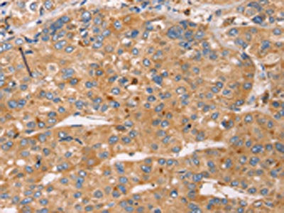 SLC25A38 Antibody