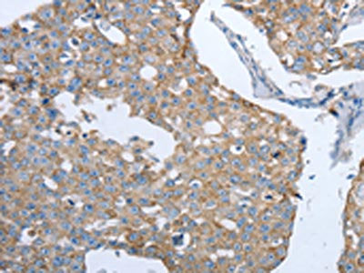 MMP19 Antibody