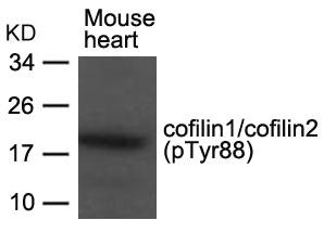 Phospho-CFL1/CFL2 (Tyr88) Antibody