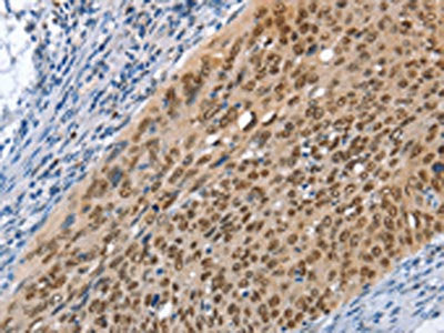 MCM6 Antibody