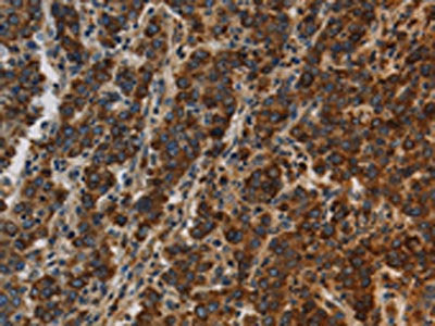 CCR8 Antibody