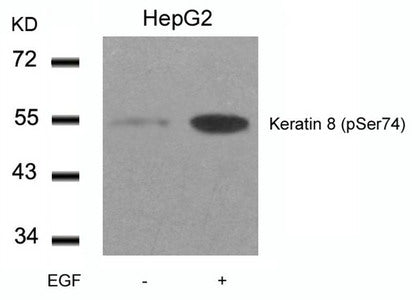 Phospho-KRT8 (Ser74) Antibody