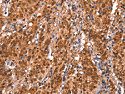 KCNJ6 Antibody