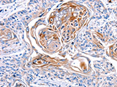CX3CL1 Antibody
