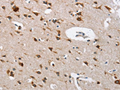 CTSL Antibody