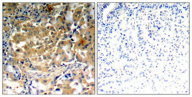 Phospho-PRKCZ (Thr410) Antibody