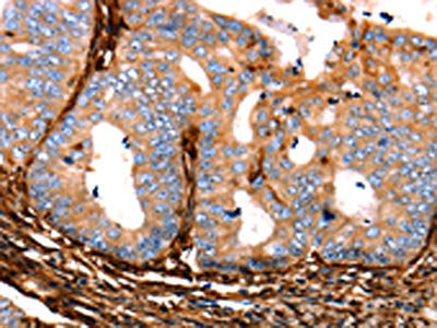 LGALS1 Antibody