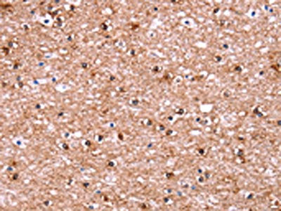 ADM2 Antibody