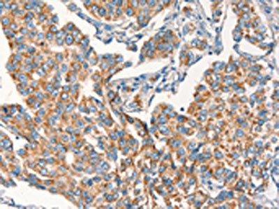 DSP Antibody