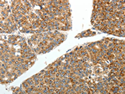 RETNLB Antibody