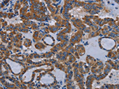 EDNRB Antibody