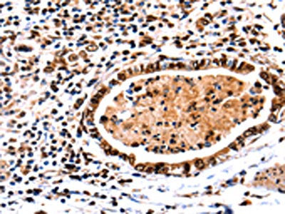 DNMT3A Antibody