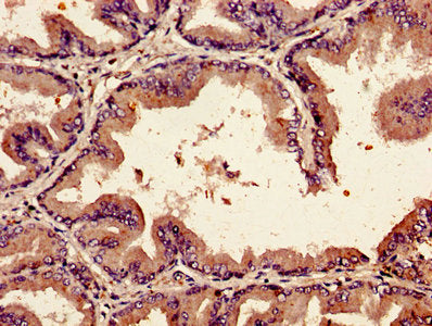BMP2 Antibody