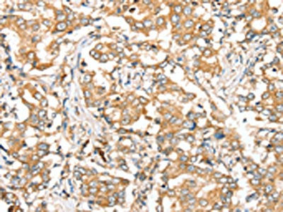 SIRT4 Antibody