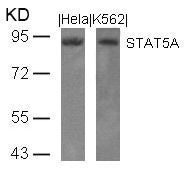 STAT5A (Ab-694) Antibody