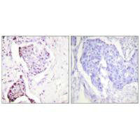 RPS27A Antibody