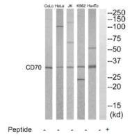 CD70 Antibody