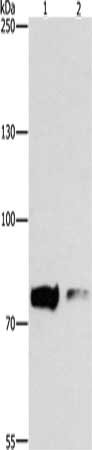 PRKCB Antibody