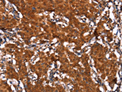 HCAR2 Antibody