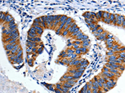 CHRM2 Antibody