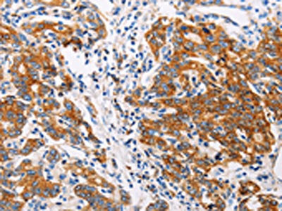 CTNNA1 Antibody