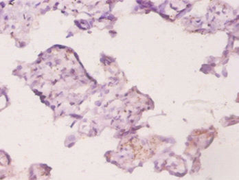UBE2K Antibody