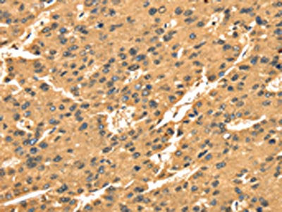 TGM1 Antibody