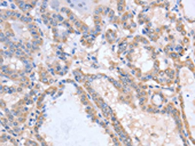 ACVR1C Antibody