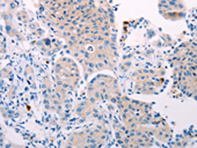 TEKT4 Antibody