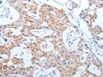 CEACAM5 Antibody