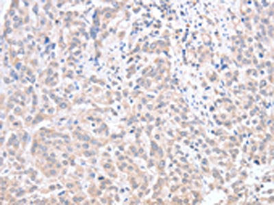 ACOT1 Antibody