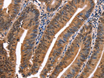 EVC2 Antibody