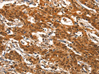 DEAF1 Antibody
