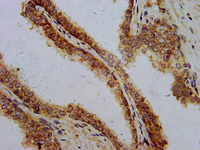 PTH Antibody
