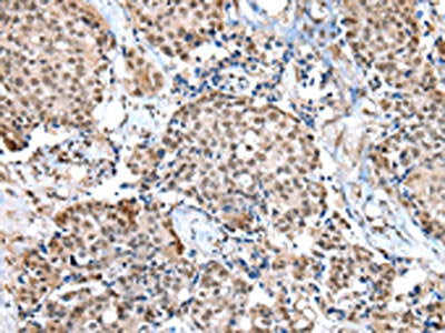 WDR5 Antibody