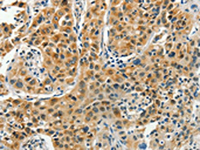 PFDN6 Antibody