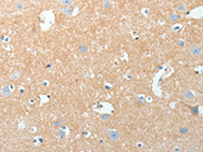 AKAP7 Antibody