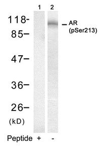 Phospho-AR (Ser213) Antibody