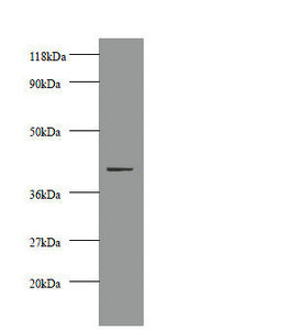 CKM Antibody