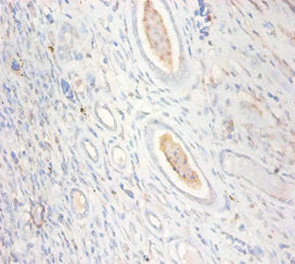 CKMT1A Antibody