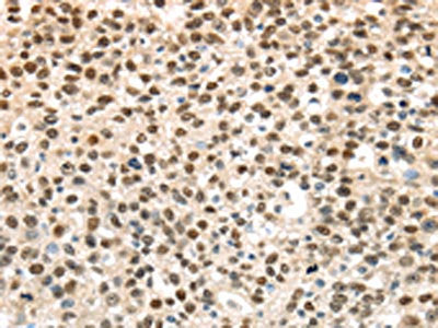 UBA1 Antibody