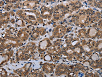 MTSS1 Antibody