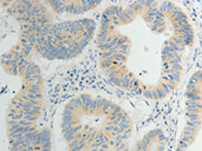 TP53BP2 Antibody