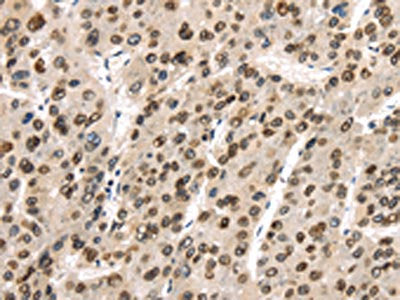 TUSC5 Antibody