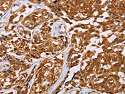 CRYAB Antibody