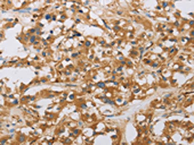RAD54L2 Antibody