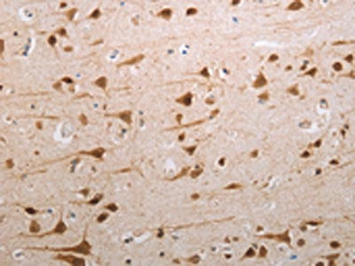 MDC1 Antibody