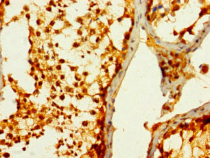 STC1 Antibody