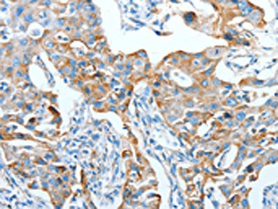 AFAP1 Antibody